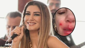 nadide sultan kaza gecirdi bYMaFOcs
