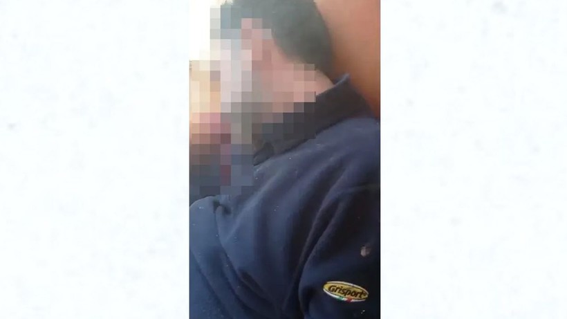dis hekimini vurup video cekmisti vahsetin asil sebebi ortaya cikti 4 kqQdZjDJ