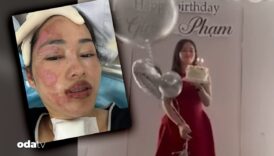 en mutlu gunu kabusa dondu hidrojen balon patladi PmnavDqM