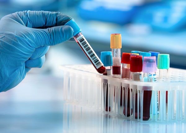 pentagonun gizli turkiye plani ermenistana virus gonderildi 2 FHPeZWKV