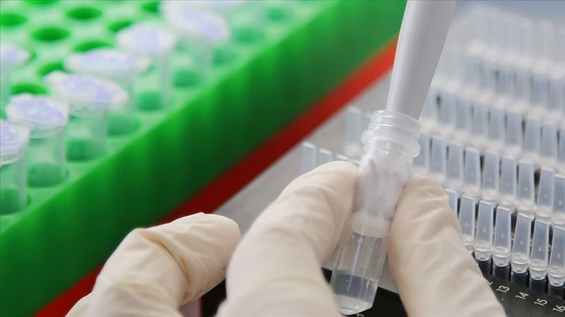 pentagonun gizli turkiye plani ermenistana virus gonderildi 4 S5vYyaMp