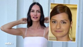 yasemin ozilhandan sasirtan estetik yaniti sadece dolgu var zJrJ2I2Y
