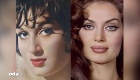 yeni polemik turkan soray estetikli mi degil mi l1977ODy
