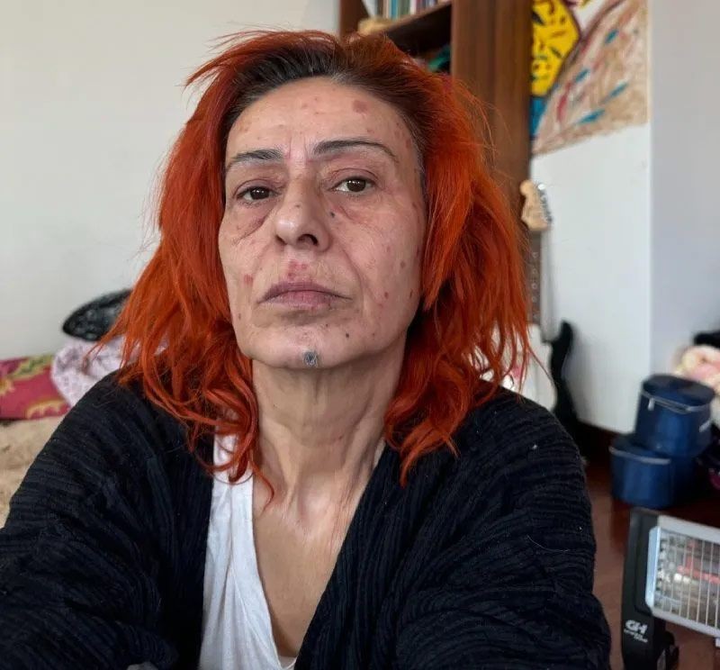 yuzu yanmisti yildiz tilbe o ani anlatti 0 1pBmym74
