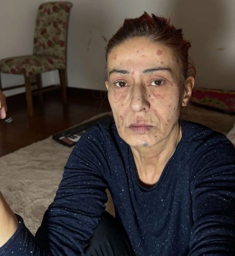 yuzu yanmisti yildiz tilbe o ani anlatti 1 k85quQp5