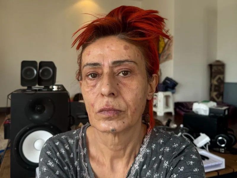 yuzu yanmisti yildiz tilbe o ani anlatti 2