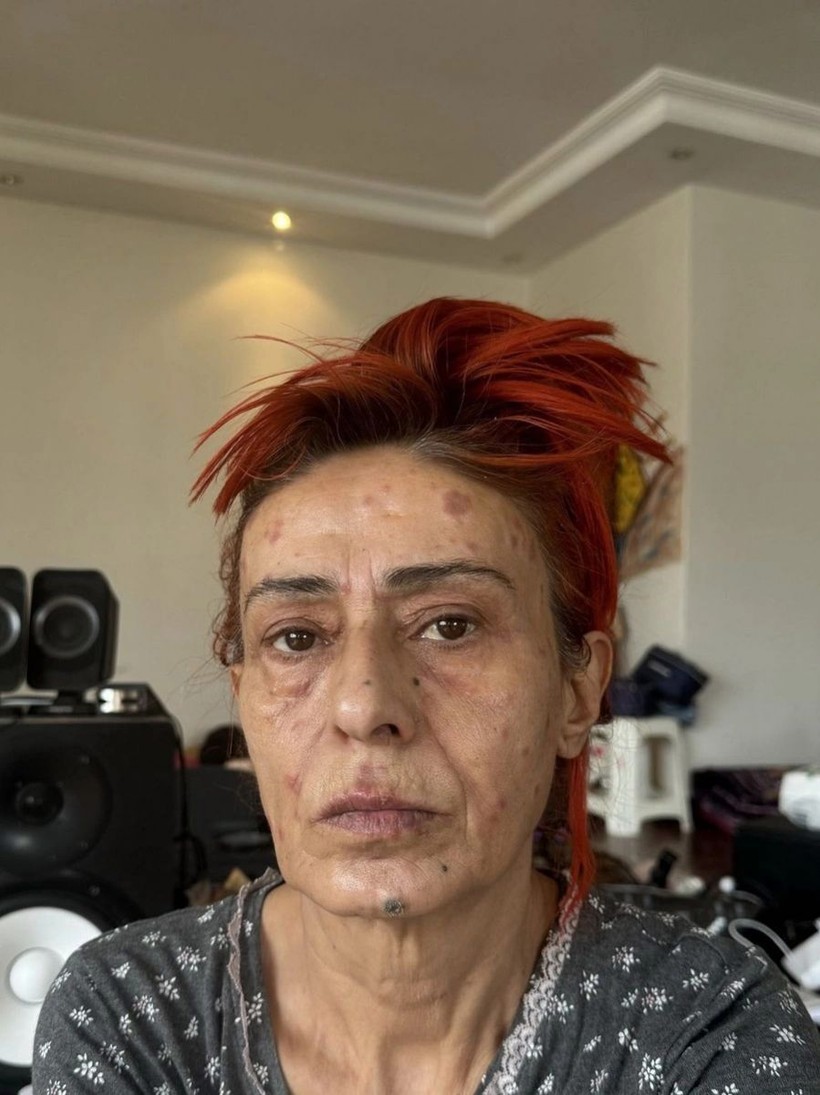 yuzu yanmisti yildiz tilbe o ani anlatti 3 eQVHXTGc