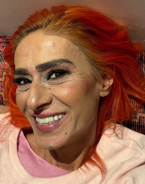 yuzu yanmisti yildiz tilbe o ani anlatti 4
