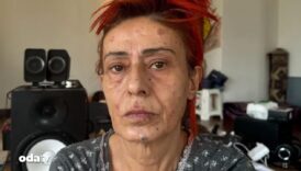 yuzu yanmisti yildiz tilbe o ani anlatti HJffz9Rb