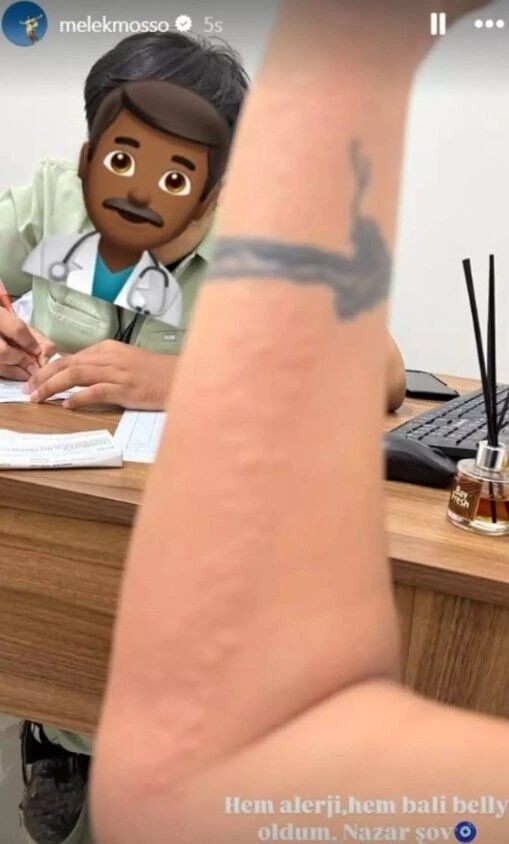 melek mosso balide hastanelik oldu 3 ZFmHhAyl