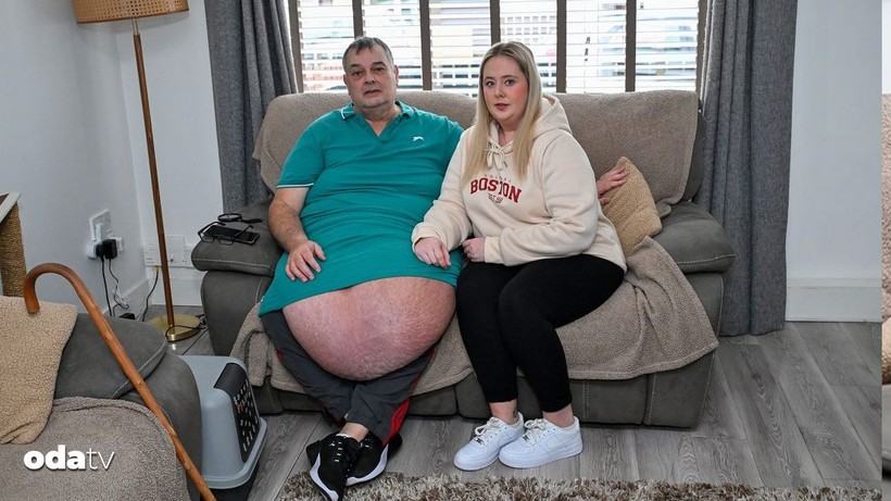 obeziteden kurtulmak icin kilo verdi daha buyuk sorunlari oldu 4 C215pfZ3
