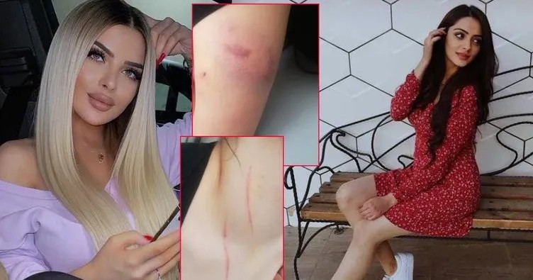 turkiyeyi sarsan taciz ve iskence biri sigara sondurdu digeri sacini kesti oburu bicakla cizdi IVMKHRNw