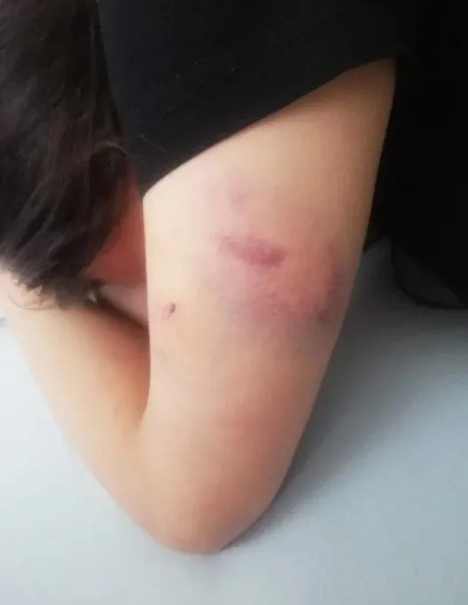 turkiyeyi sarsan taciz ve iskence biri sigara sondurdu digeri sacini kesti oburu bicakla cizdi L1tBNk4E