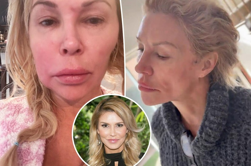 unlu oyuncu brandi glanvillenin yuzunde parazitler hareket ediyor perisan haldeyim 0 St9bid7j