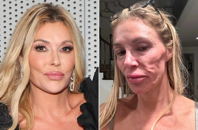 unlu oyuncu brandi glanvillenin yuzunde parazitler hareket ediyor perisan haldeyim 1 AQLaWmVw